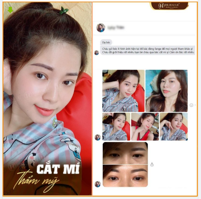 Ly Ly Trần: "Cháu gửi bác ít hình ảnh hiện tại để bác đăng fanpage để mọi người tham khảo ạ! Cháu đã giới thiệu rất nhiều bạn bè cháu qua bác cắt mí ạ! Cảm ơn Bác rất nhiều... ​​​​​​​"
