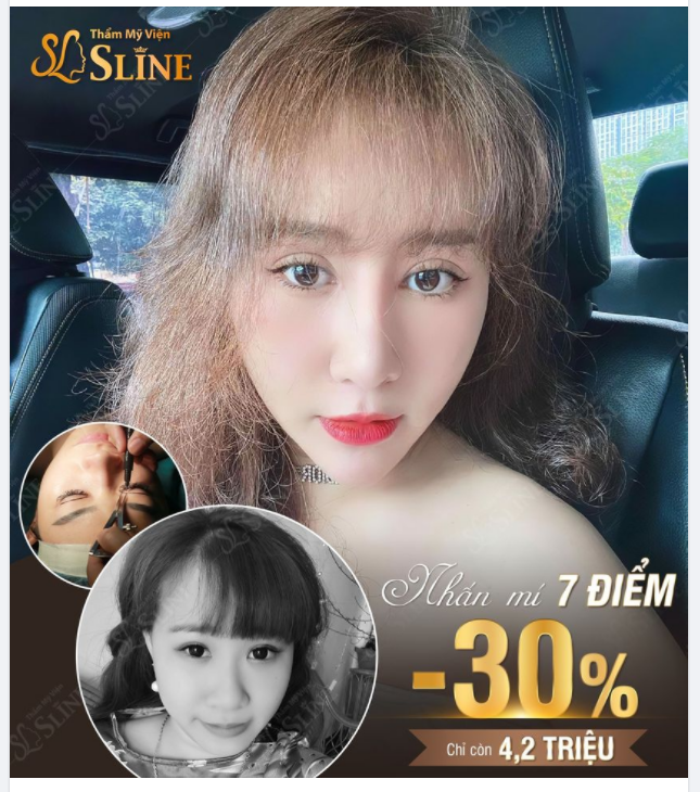 MẮT ĐẸP MÍ XINH CHỈ TỪ 4.2 TRIỆU