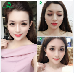 MẮT ĐẸP RẠNG NGỜI - CHI PHÍ CỰC HỜI