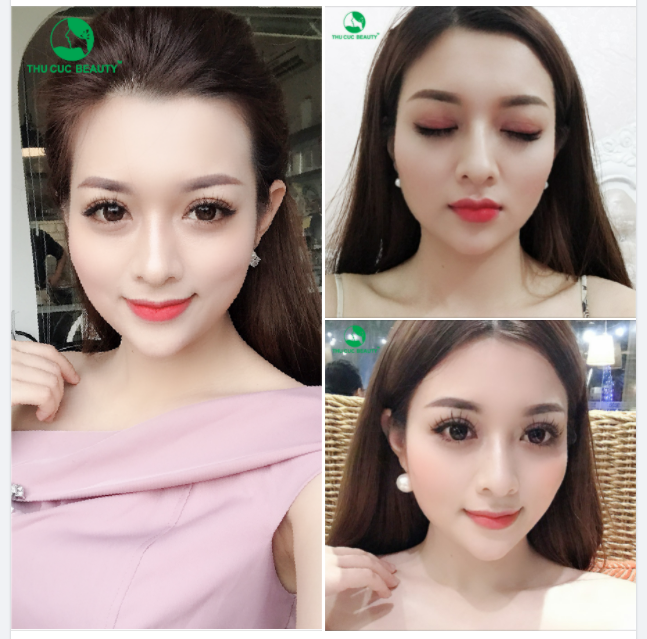 MẮT ĐẸP RẠNG NGỜI - CHI PHÍ CỰC HỜI