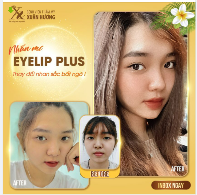 MẮT ĐẸP TỰ NHIÊN NHƯNG KHÔNG TỰ NHIÊN MÀ ĐẸP