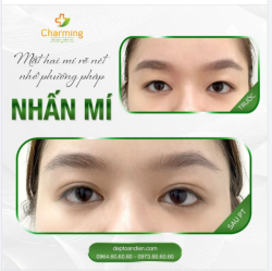 Mắt mí đơn hóa mí đôi nhờ nhấn mí là chuyện bình thường ở huyện, điều đặc biệt mà hôm nay Charming muốn khoe với mọi người là khả năng làm đẹp cho đôi mắt hai mí.