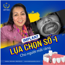MẤT RĂNG HÃY CHỌN TRỒNG RĂNG IMPLANT