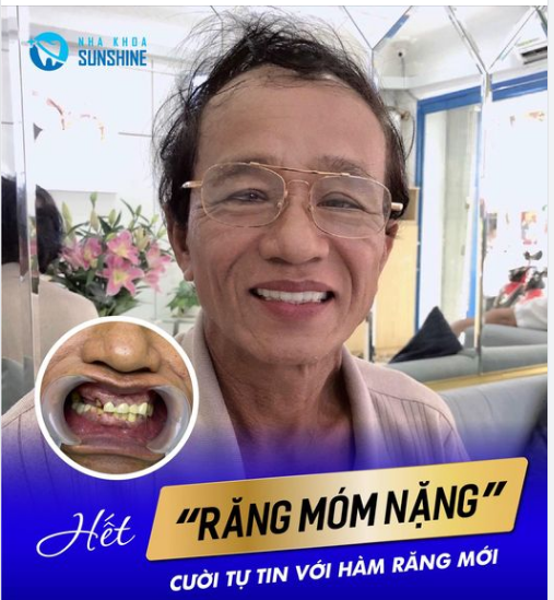 MẤT RĂNG Ở NGƯỜI CAO TUỔI GÂY SUY YẾU NHANH HƠN, ĐÚNG HAY SAI?