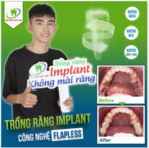 MẤT RĂNG SỚM TRẢI NGHIỆM KINH KHỦNG VỚI BẤT CỨ AI