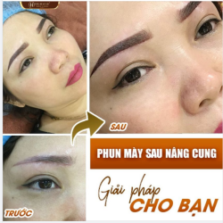 Mắt sụp mí muốn đi nâng cung mày nhưng sợ đụng chạm đến phần lông mày hoặc lộ đường rạch. CHUYỆN NHỎ!