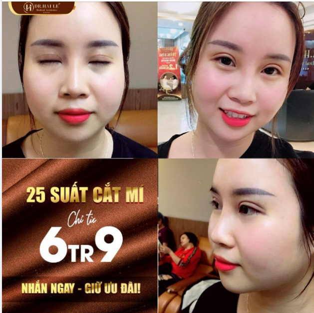 MAX XINH ĐẸP - MIN CHI PHÍ!