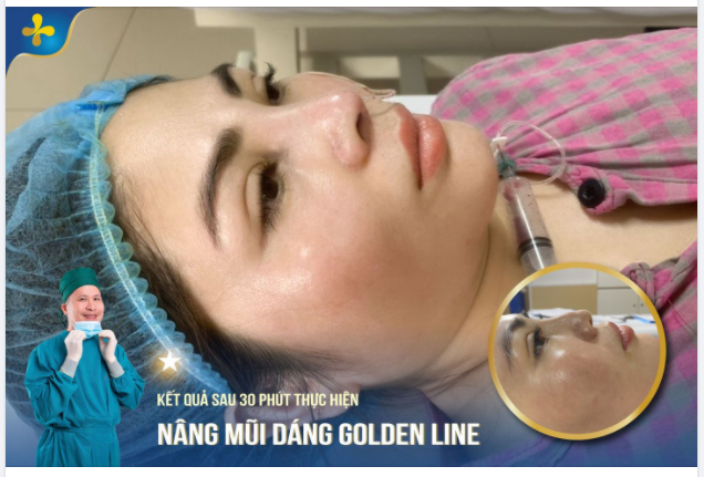 May mắn sống mũi cao nhưng có một chút gồ ghề, bạn gái tìm đến Dr.Tống Hải nhờ giúp đỡ.