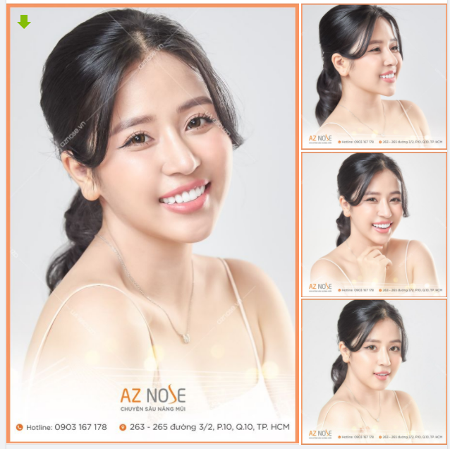 MC Cao Vy tin chọn nâng mũi tại AZ NOSE vì điều gì