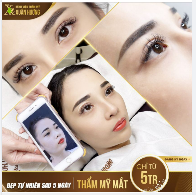 MÍ MẮT ĐẸP SẮC NÉT CHỈ TỪ 5 TRIỆU - THỰC HIỆN AN TOÀN LẠI KẾT QUẢ TỰ NHIÊN