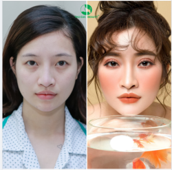 MÍ XINH SẮC NÉT - MẮT ĐẸP HÚT HỒN CHỈ TỪ 4.5 TRIỆU
