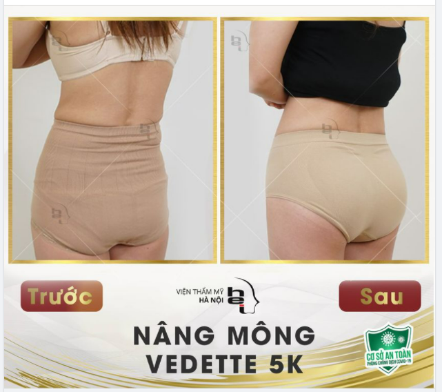 MÔNG QUẢ ĐÀO CÓ KHIẾN CHÀNG XUYẾN XAO?