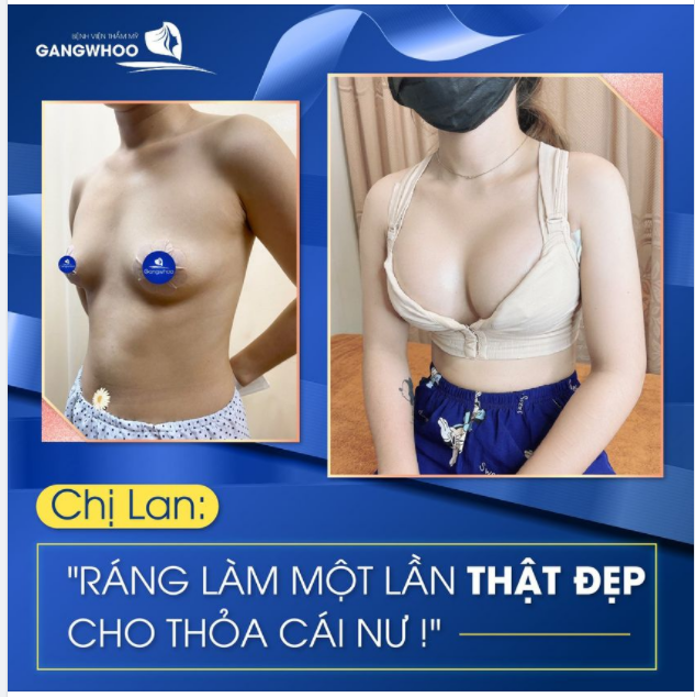 MONG ƯỚC ĐƯỢC SỞ HỮU VÒNG 1 QUYẾN RŨ ĐÃ TRỞ THÀNH HIỆN THỰC