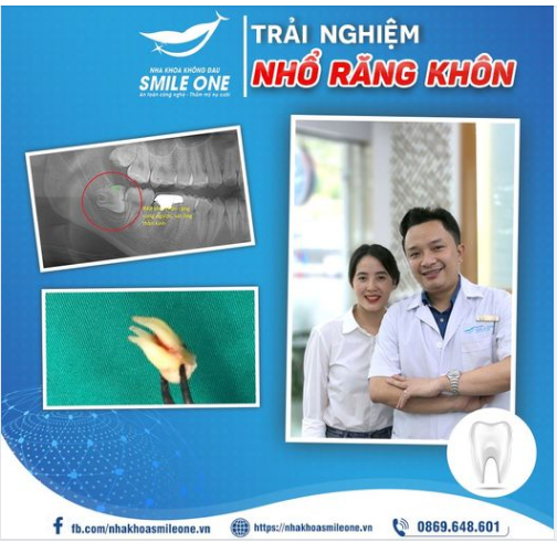 MỘT CA NHỔ RĂNG KHÔN PHẢI GỌI LÀ ĐỈNH CỦA CHÓP