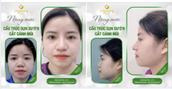 Một chiếc mũi cao, sóng mũi thẳng, dài và cánh mũi gọn gàng đã giúp nàng khách của Charming có được khuôn mặt thon gọn và hài hòa, cân đối hơn hẳn.