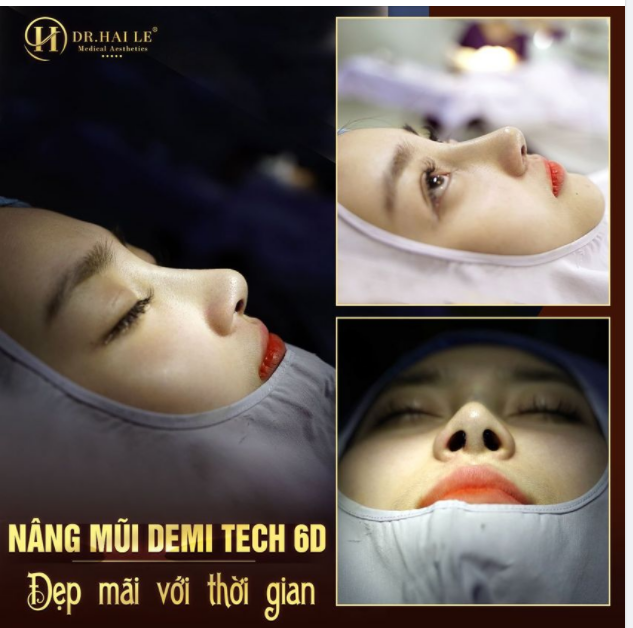 Một dáng mũi siêu đẹp ngay 60 phút nâng Nhìn góc nào cũng phải thả triệu like  thả triệu tim thế này đây ạ