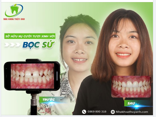 MỘT NỤ CƯỜI LÀ VẠN ĐIỀU Ý NGHĨA