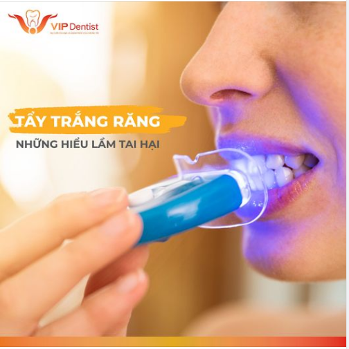 Một số người cho rằng, việc tẩy trắng răng có thể gây ra các tác hại như: Làm mòn men răng, khiến răng yếu đi…