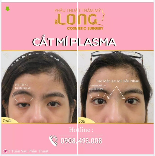 MÙA DỊCH Ở NHÀ THÌ MÌNH LÀM GÌ ? MÌNH CÙNG NGẮM THÀNH QUẢ CỦA KHÁCH HÀNG NHÀ BÁC SĨ LONG NHÉ!