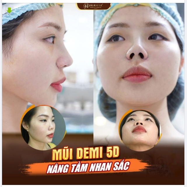 MŨI CAO CÓ LÀM EM LAO XAO ?