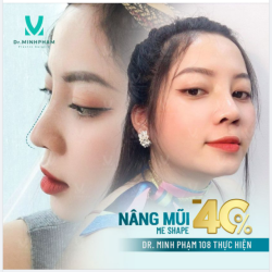 MŨI CAO TÂY – NGẤT NGÂY THẦN THÁI VỚI QUÀ TẶNG LÊN TỚI 40% CHI PHÍ
