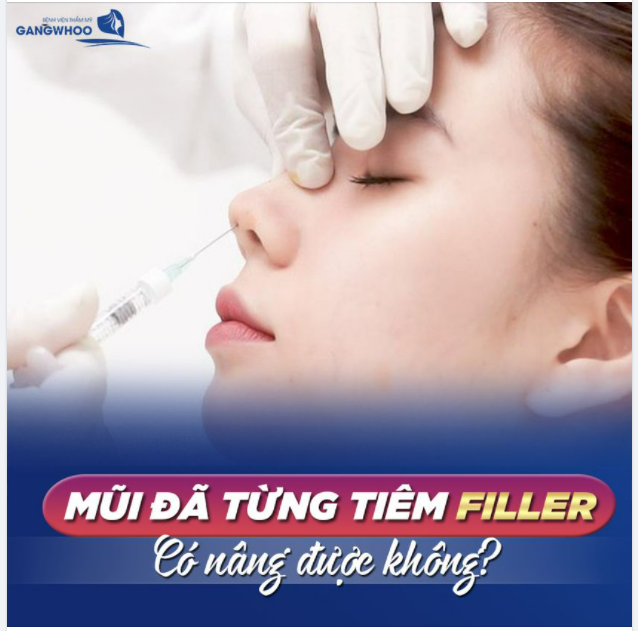 MŨI ĐÃ TỪNG TIÊM FILLER CÓ NÂNG ĐƯỢC KHÔNG?