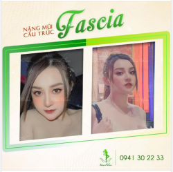 MŨI HẠT CHANH ĐÚNG "CHUẨN" BẤT CHẤP MỌI GÓC ĐỘ