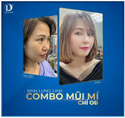 "Mũi mí tự nhiên lắm bác sĩ ạ. Nếu em không nói thì không ai nhận ra đã can thiệp dao kéo, chỉ bảo là dạo này trông xinh hẳn thôi. Đỉnh cao tạo hình thẩm mỹ chính là đây."