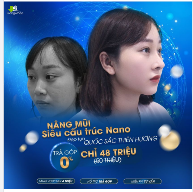 MŨI NANO – CHO BẠN VẺ ĐẸP QUỐC SẮC THIÊN HƯƠNG