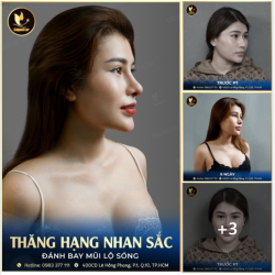 MŨI XINH LÀ PHẢI TỰ NHIÊN NÂNG MŨI SỬA LẠI, NÂNG CẤP NHAN SẮC LÊN MỘT TẦM CAO MỚI