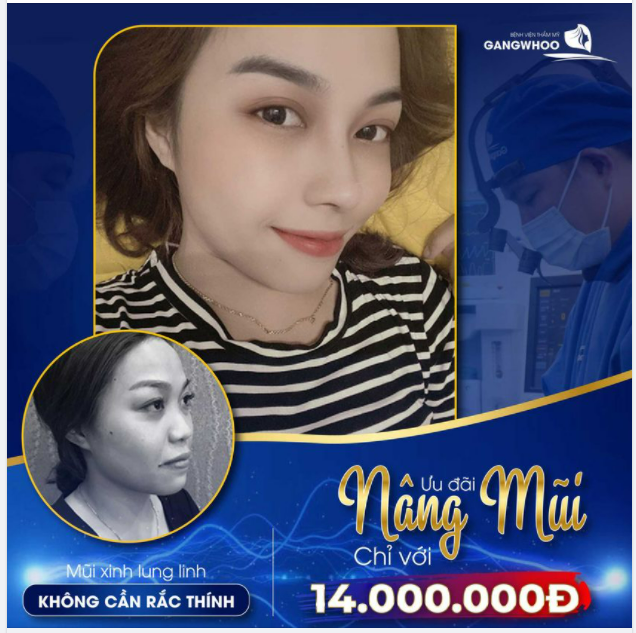 MŨI XINH LUNG LINH , KHÔNG CẦN RẮC THÍNH - ƯU ĐÃI NÂNG MŨI CHỈ VỚI 14.000.000Đ
