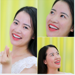 MUỐN CƯỜI ĐẸP KHÔNG KHÓ  ĐẾN NHA KHOA GIA ĐÌNH CÓ NGAY