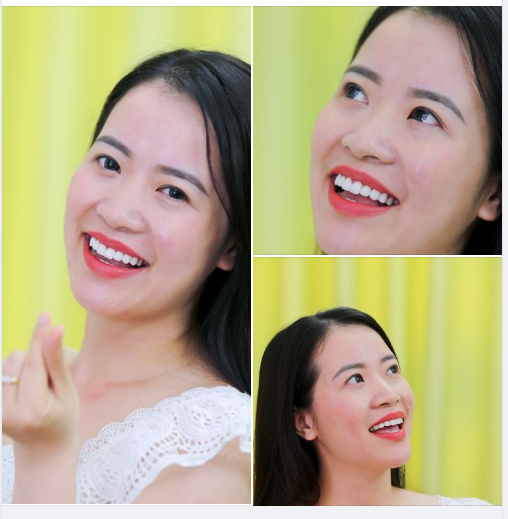MUỐN CƯỜI ĐẸP KHÔNG KHÓ  ĐẾN NHA KHOA GIA ĐÌNH CÓ NGAY