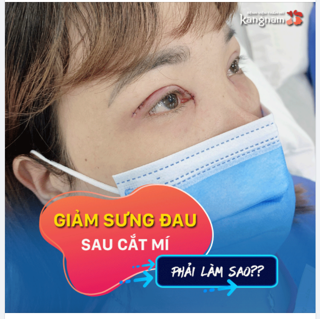 Muốn GIẢM SƯNG SAU CẮT MÍ Đọc ngay những chia sẻ từ bác sĩ chuyên khoa:
