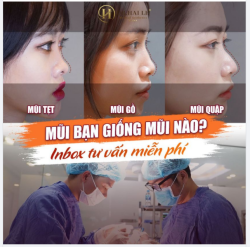 Muôn hình vạn trạng các dáng mũi Mũi tẹt, mũi hếch, mũi gồ, mũi quặp.... Đâu là dáng mũi hiện tại của bạn?