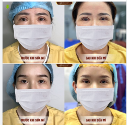 MUÔN HÌNH VẠN TRẠNG CÁC TÌNH TRẠNG MÍ LỖI HỎNG VÀ CÂU CHUYỆN CUỘC SỐNG XẢY ĐẾN SAU ĐÓ