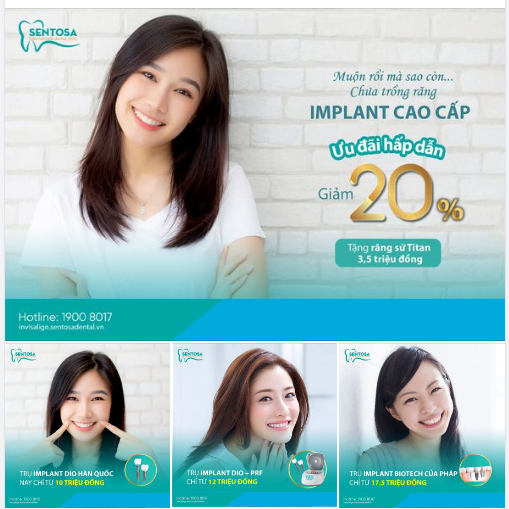 MUỘN RỒI MÀ SAO CÒN CHƯA TRỒNG RĂNG VỚI KỸ THUẬT TIÊN TIẾN