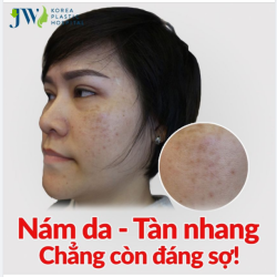 NÁM DA - TÀN NHANG CẦN GÌ PHẢI SỢ!
