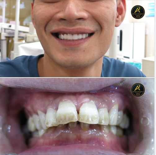 Nam giới, đa số đều muốn ngắm nhìn những người phụ nữ đẹp, duyên dáng