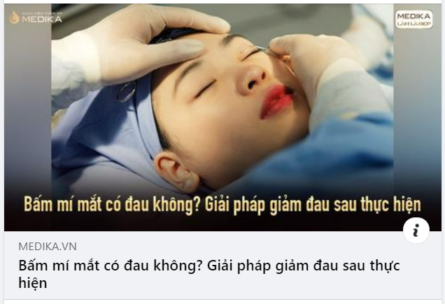 Nằm trong top những phương pháp thẩm mỹ mắt an toàn, hiện đại, bấm mí mắt hay còn gọi là nhấn mí mắt được các chị em yêu thích áp dụng rất phổ biến.