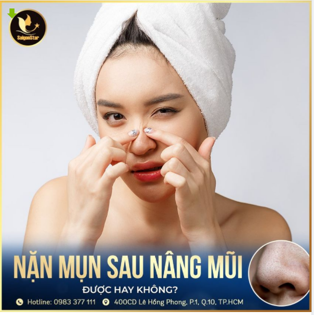 NẶN MỤN SAU NÂNG MŨI, ĐƯỢC HAY KHÔNG?
