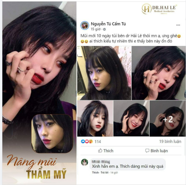 Nàng ấy làm mũi xong kêu ưng quá, biết thế đã làm sớm hơn rồi, có mũi đẹp là phải khoe luôn mới chịu, người đâu vừa XINH ĐẸP LẠI DUYÊN DÁNG, đáng yêu cực luôn ạ