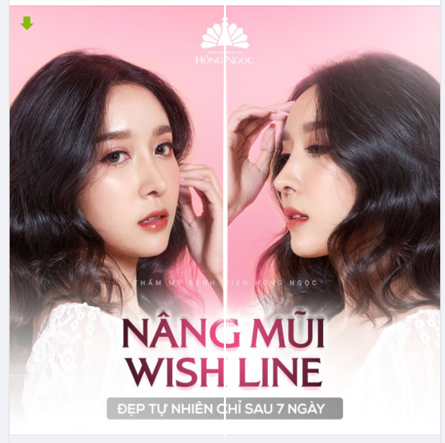 ''NÂNG CẤP'' BẢN THÂN VỚI DÁNG MŨI WISH LINE ĐỘC QUYỀN TẠI THẨM MỸ BỆNH VIỆN HỒNG NGỌC