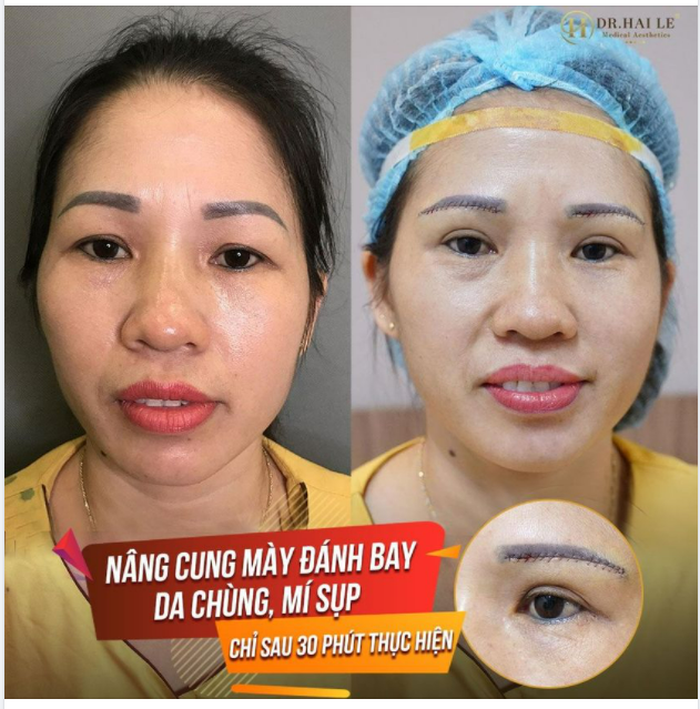 NÂNG CUNG MÀY - ĐÁNH BAY LÃO HÓA CHỈ SAU 30 PHÚT!