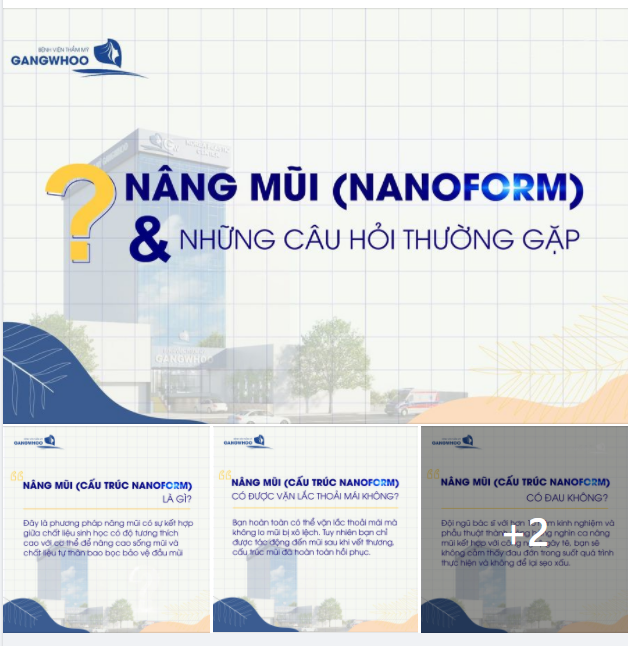 NÂNG MŨI (CẤU TRÚC NANOFORM) VÀ NHỮNG CÂU HỎI THƯỜNG GẶP