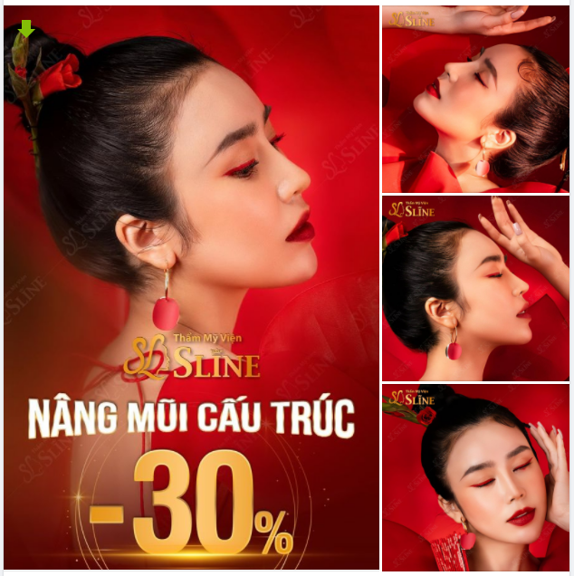 NÂNG MŨI CẤU TRÚC SOFTXIL " BÍ QUYẾT CHO DÁNG MŨI CHUẨN TỶ LỆ VÀNG"