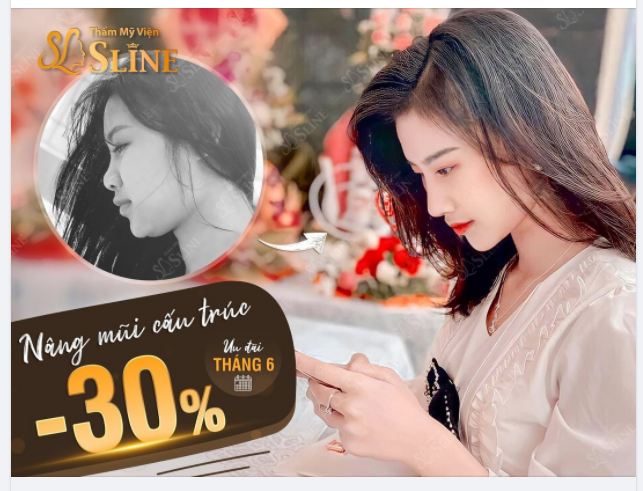 NÂNG MŨI CẤU TRÚC SOFTXIL