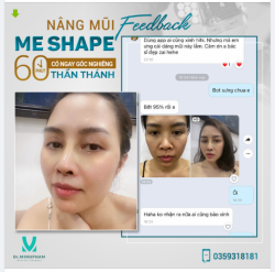 NÂNG MŨI ME SHAPE TẠI DR MINH PHẠM MŨI CAO TÂY - ĐẸP NGAY SAU LÀM