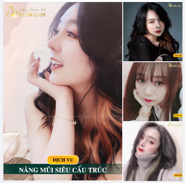 NÂNG MŨI SIÊU CẤU TRÚC - NÂNG TẦM SỨC HÚT - ĐẸP ĐẾN TỪNG MILIMET.