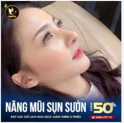 ​​​​​​​ NÂNG MŨI SỤN SƯỜN BÁC SĨ HOẠT – NÂNG LÀ ĐẸP